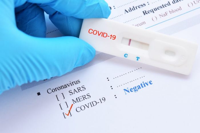 Мошенники продают фальшивые результаты тестов на коронавирус