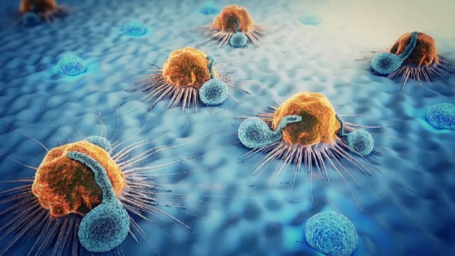 Онколог Евсеев назвал первый симптом очень агрессивного рака, который прячется в неожиданном месте